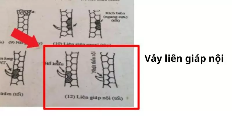 Vảy liên giáp nội thường bị “mới chê”, “cũ khen” về sức chiến